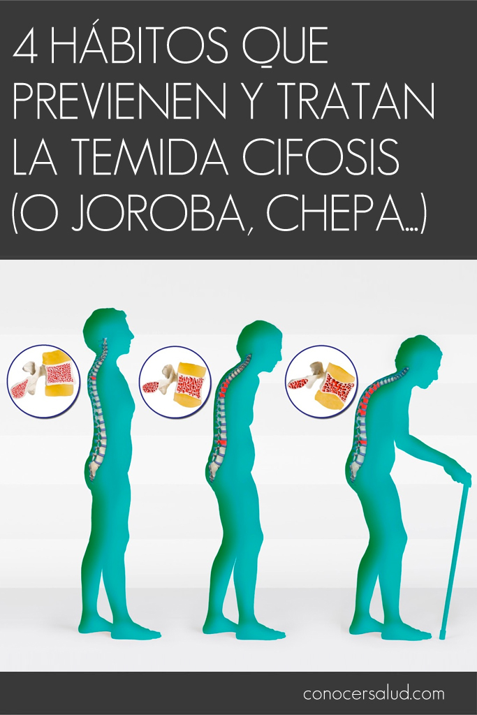 4 hábitos que previenen y tratan la temida cifosis (o joroba, chepa...)