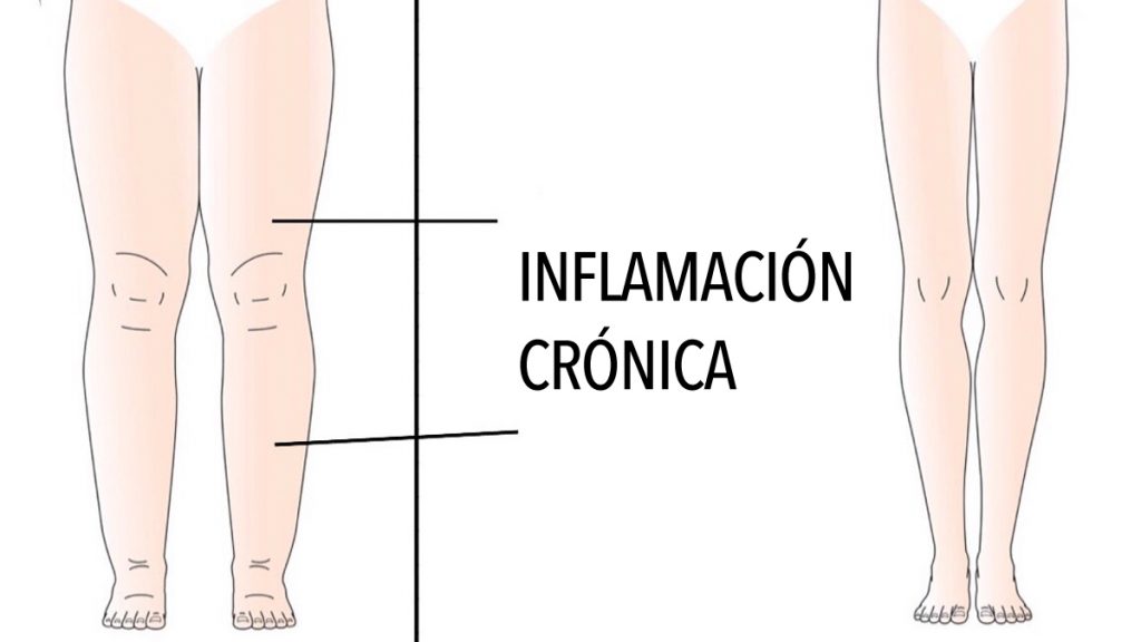 5 Razones por las que su cuerpo se inflama (y cómo evitarlo)