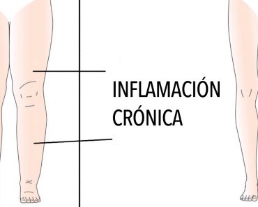 5 Razones por las que su cuerpo se inflama (y cómo evitarlo)