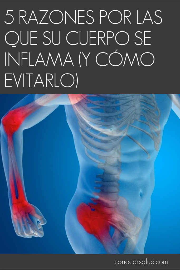 5 Razones por las que su cuerpo se inflama (y cómo evitarlo)