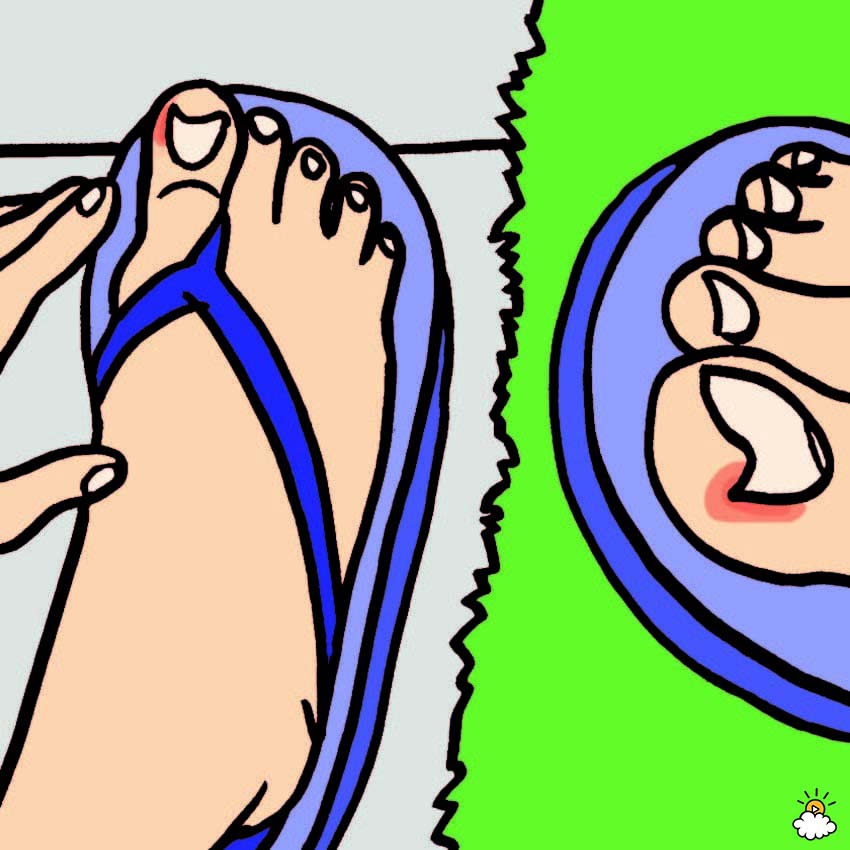 Uñas encarnadas de los pies: 6 Remedios caseros sorprendentemente efectivos