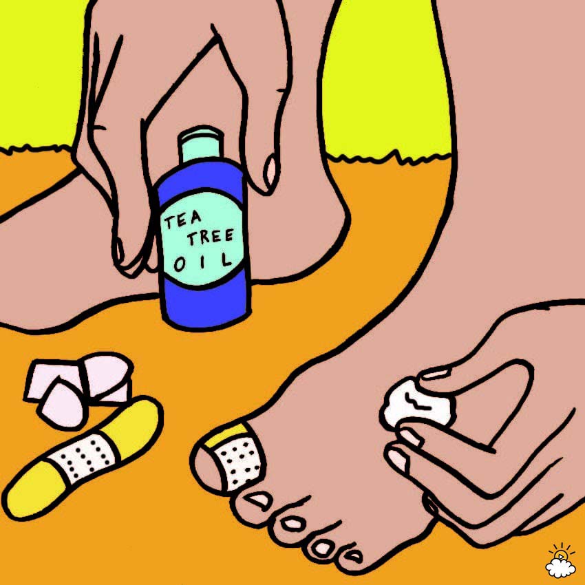 Uñas encarnadas de los pies: 6 Remedios caseros sorprendentemente efectivos