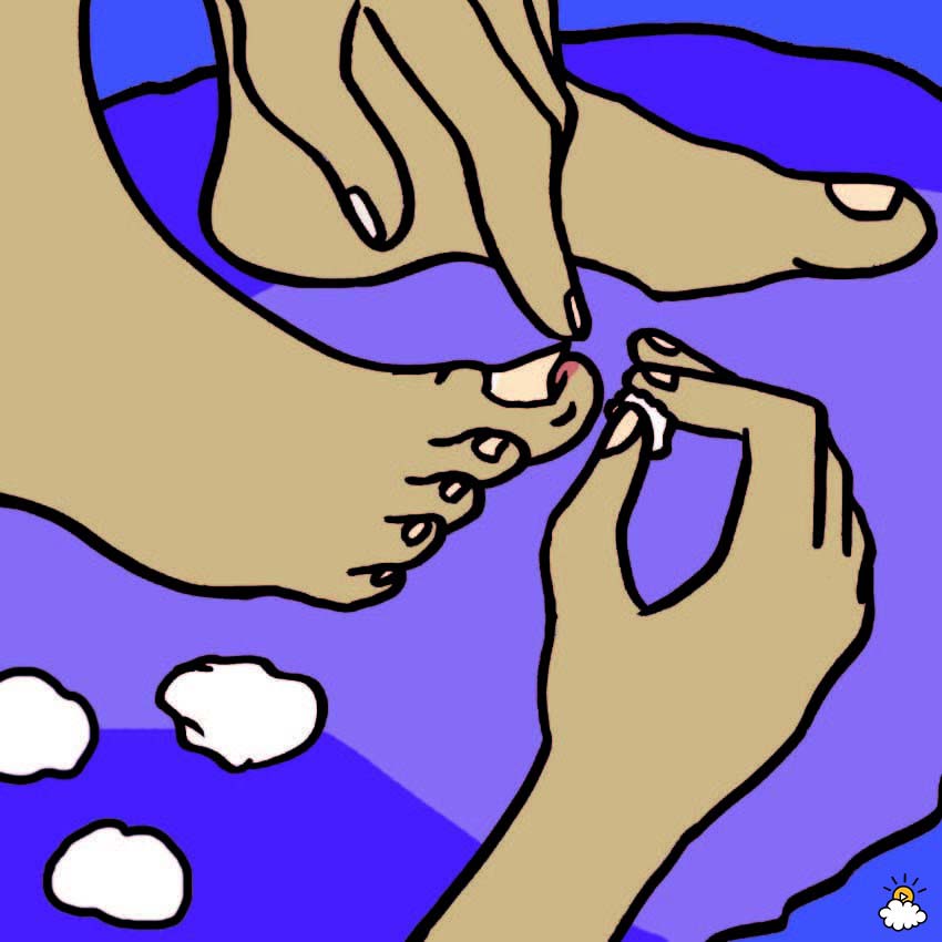 Uñas encarnadas de los pies: 6 Remedios caseros sorprendentemente efectivos