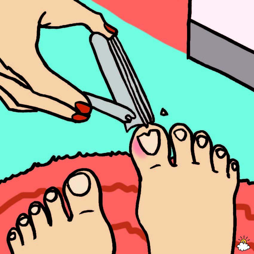 Uñas encarnadas de los pies: 6 Remedios caseros sorprendentemente efectivos