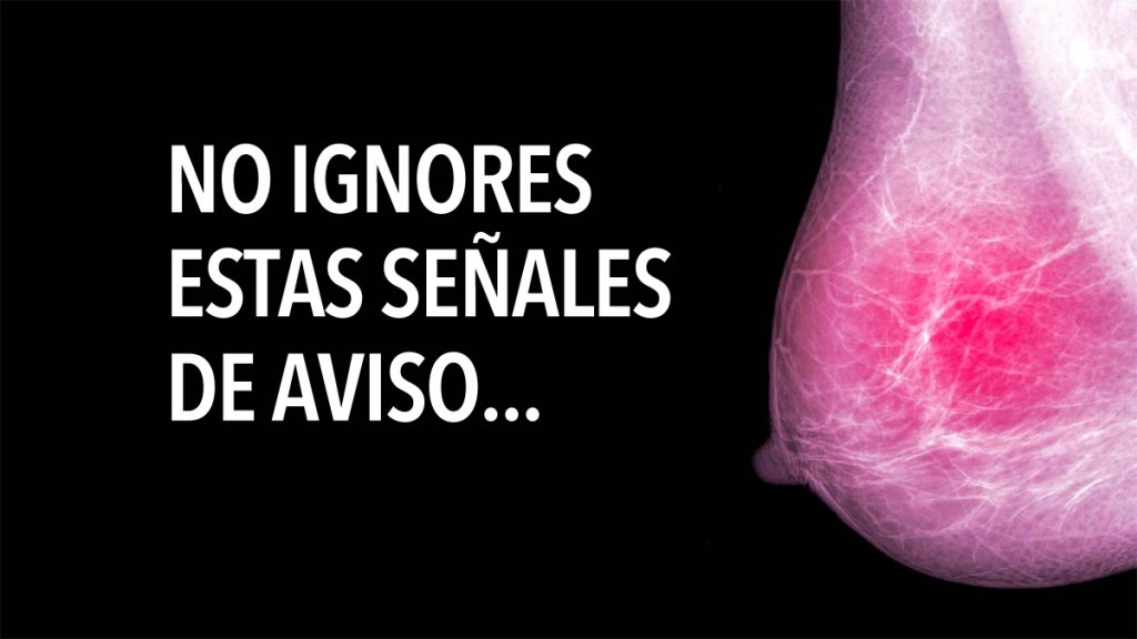 5 Señales de alerta temprana sobre el cáncer de mama que la mayoría de las mujeres ignoran