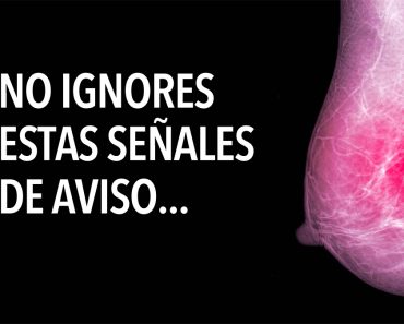 5 Señales de alerta temprana sobre el cáncer de mama que la mayoría de las mujeres ignoran