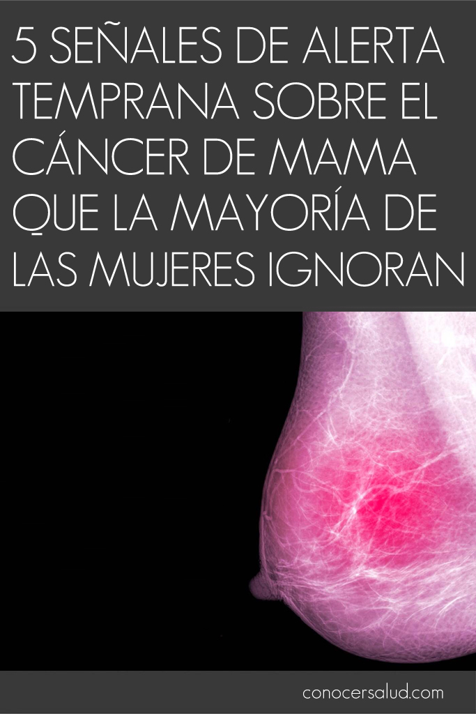 5 Señales de alerta temprana sobre el cáncer de mama que la mayoría de las mujeres ignoran
