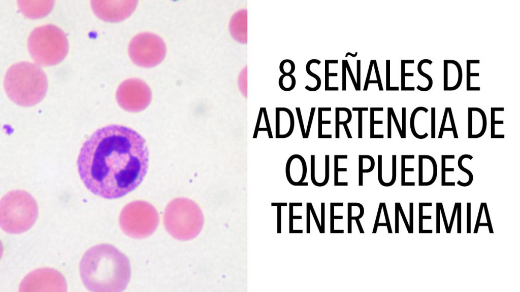 8 Señales de advertencia de que puedes tener anemia