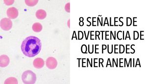 8 Señales de advertencia de que puedes tener anemia