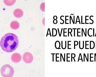 8 Señales de advertencia de que puedes tener anemia