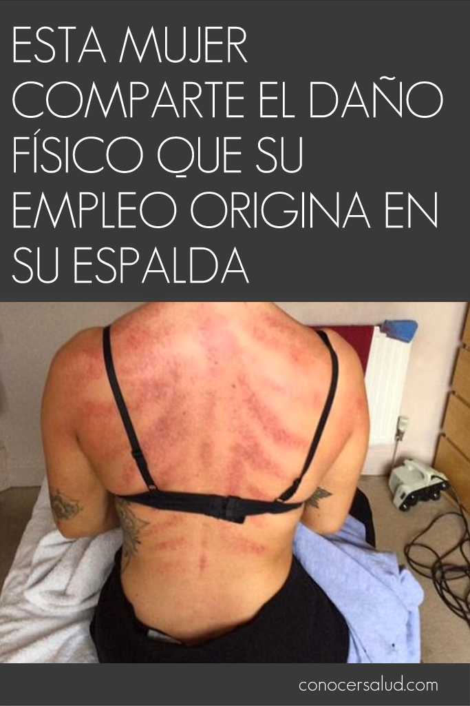 Esta mujer comparte el daño físico que su empleo origina en su espalda