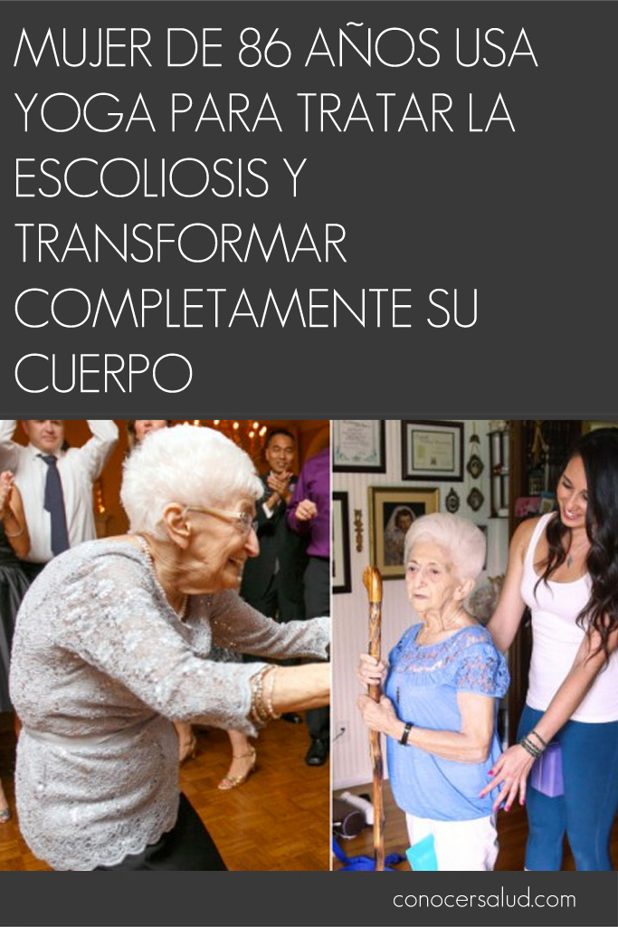 Mujer de 86 años usa yoga para tratar la escoliosis y transformar completamente su cuerpo