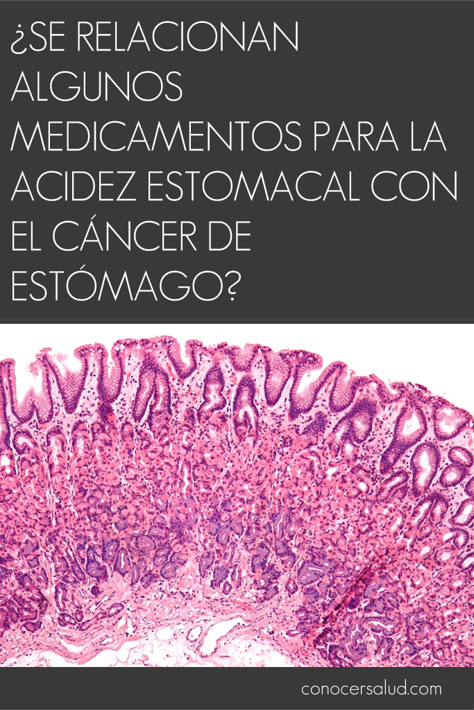 ¿Se relacionan algunos medicamentos para la acidez estomacal con el cáncer de estómago?