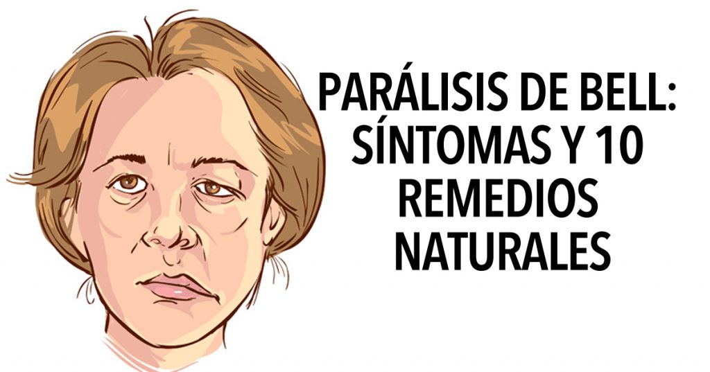 Parálisis De Bell: Síntomas y 10 remedios naturales