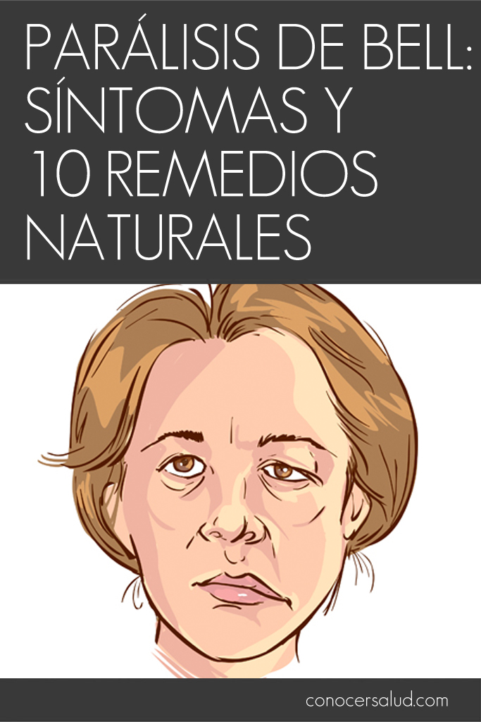 Parálisis De Bell: Síntomas y 10 remedios naturales