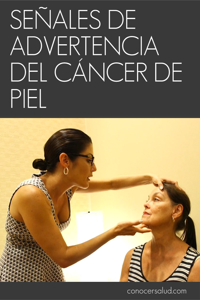 Estas son las señales de advertencia del cáncer de piel