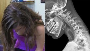 El 'cuello de texto' es real: 6 ejercicios para prevenir la degeneración de tu columna vertebral