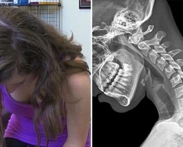 El 'cuello de texto' es real: 6 ejercicios para prevenir la degeneración de tu columna vertebral