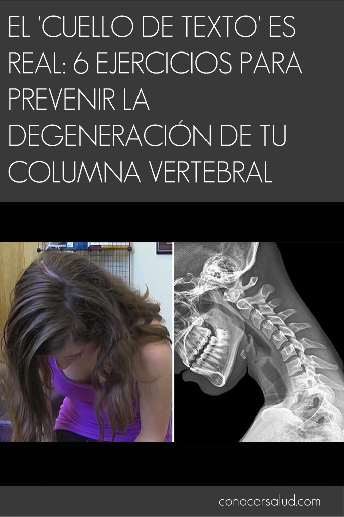 El 'cuello de texto' es real: 6 ejercicios para prevenir la degeneración de tu columna vertebral