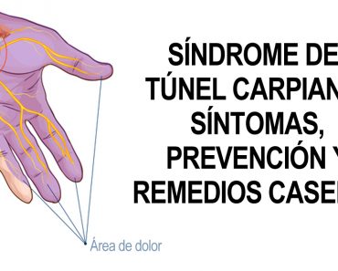 Síndrome del túnel carpiano: Síntomas, prevención y remedios caseros Síndrome del túnel carpiano: Síntomas, prevención y remedios caseros