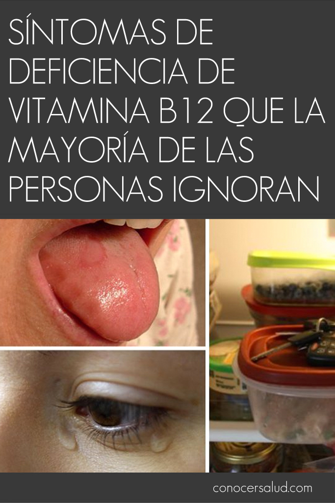 Síntomas de deficiencia de vitamina B12 que la mayoría de las personas ignoran