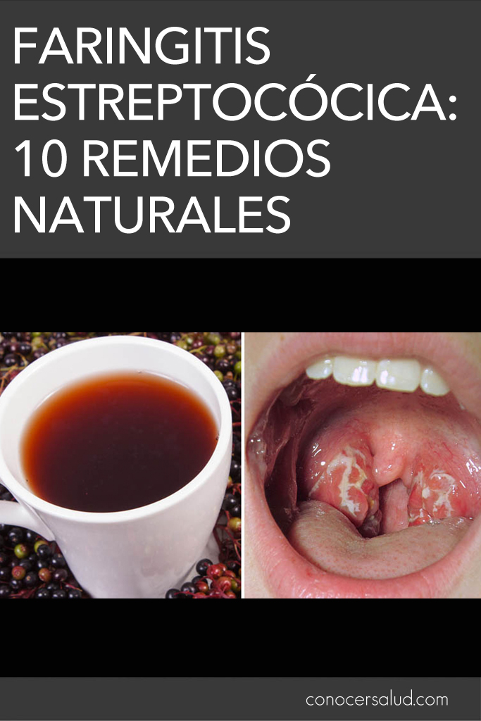 Faringitis estreptocócica: 10 remedios naturales