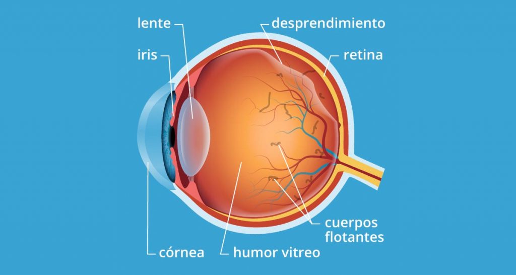 Flotadores en sus ojos: causas principales y algunos consejos para prevenirlos