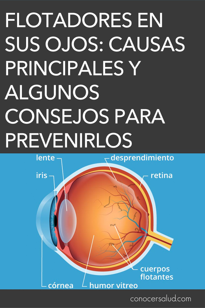 Flotadores en sus ojos: causas principales y algunos consejos para prevenirlos