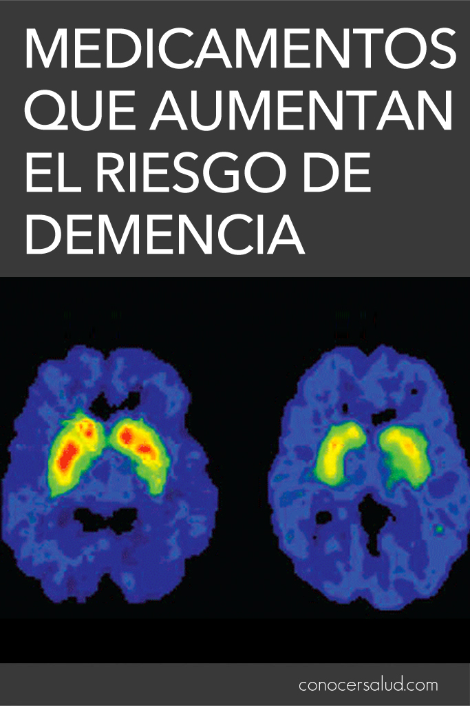 Medicamentos que aumentan el riesgo de demencia