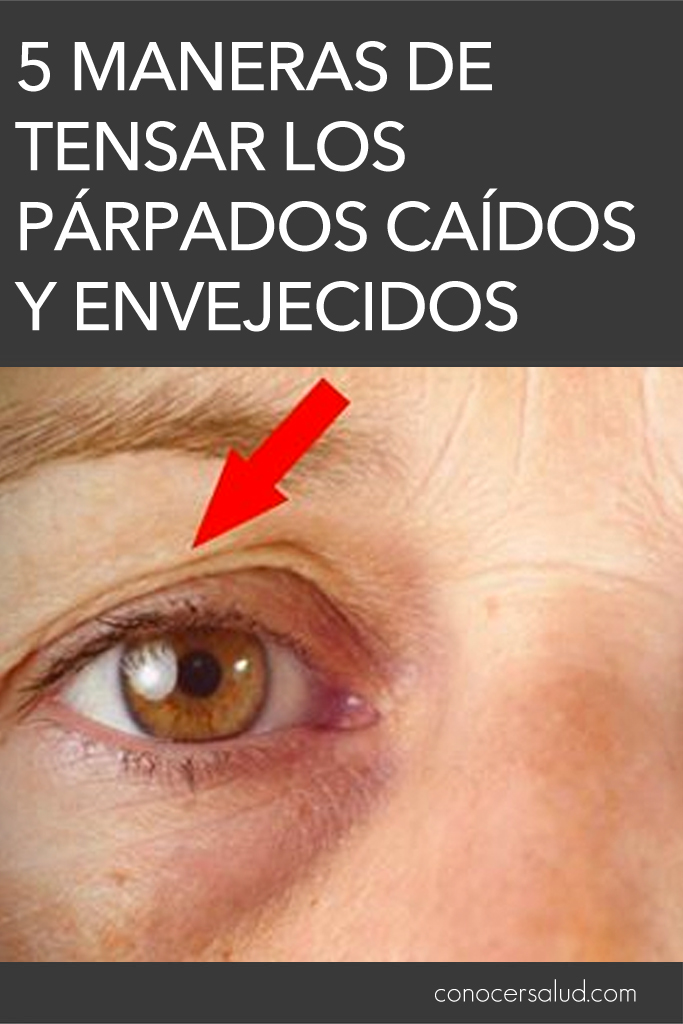 5 maneras de tensar los párpados caídos y envejecidos