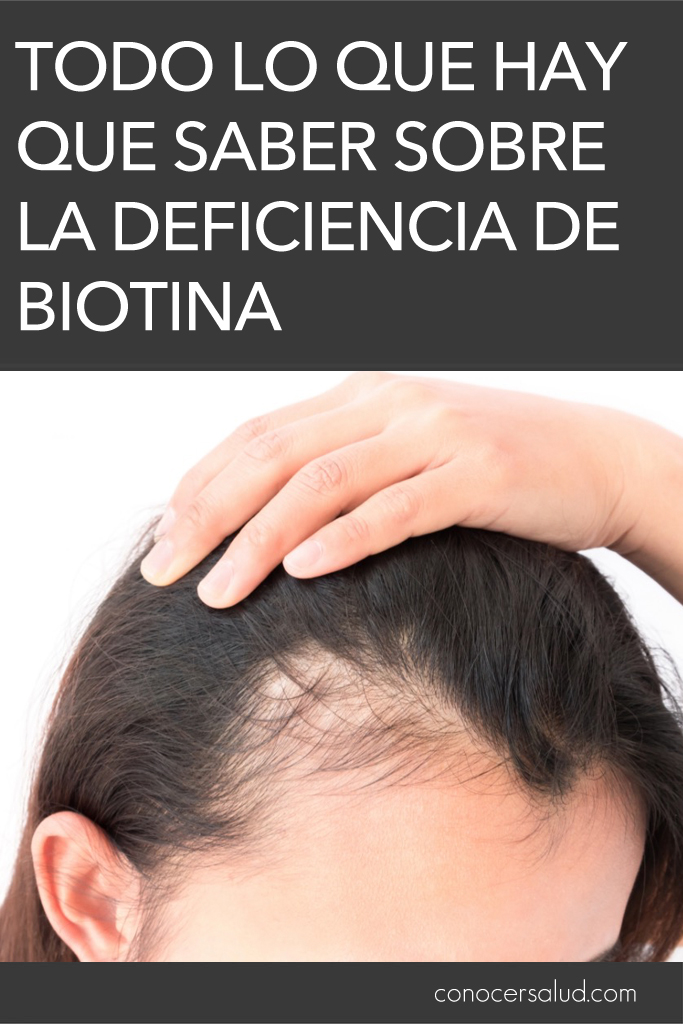 Todo lo que hay que saber sobre la deficiencia de biotina