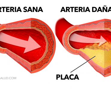 7 maneras simples de limpiar sus arterias naturalmente