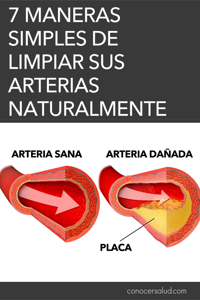 7 maneras simples de limpiar sus arterias naturalmente