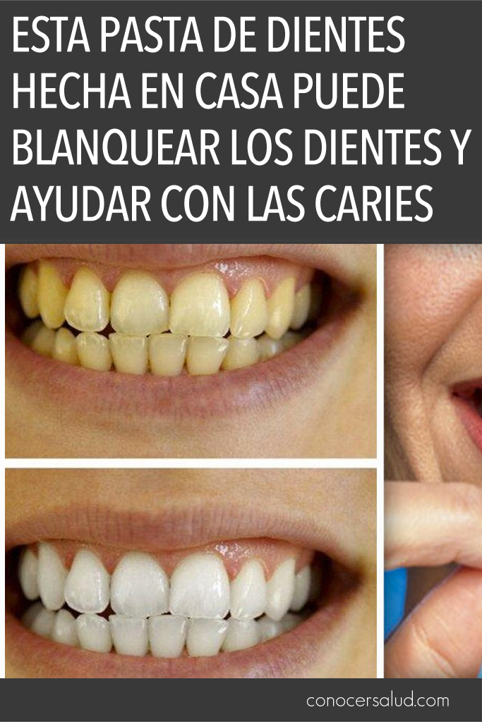 Esta pasta de dientes hecha en casa puede blanquear los dientes y ayudar con las caries