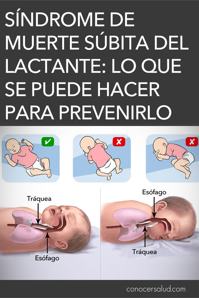 Síndrome de muerte súbita del lactante: Lo que se puede hacer para prevenirlo