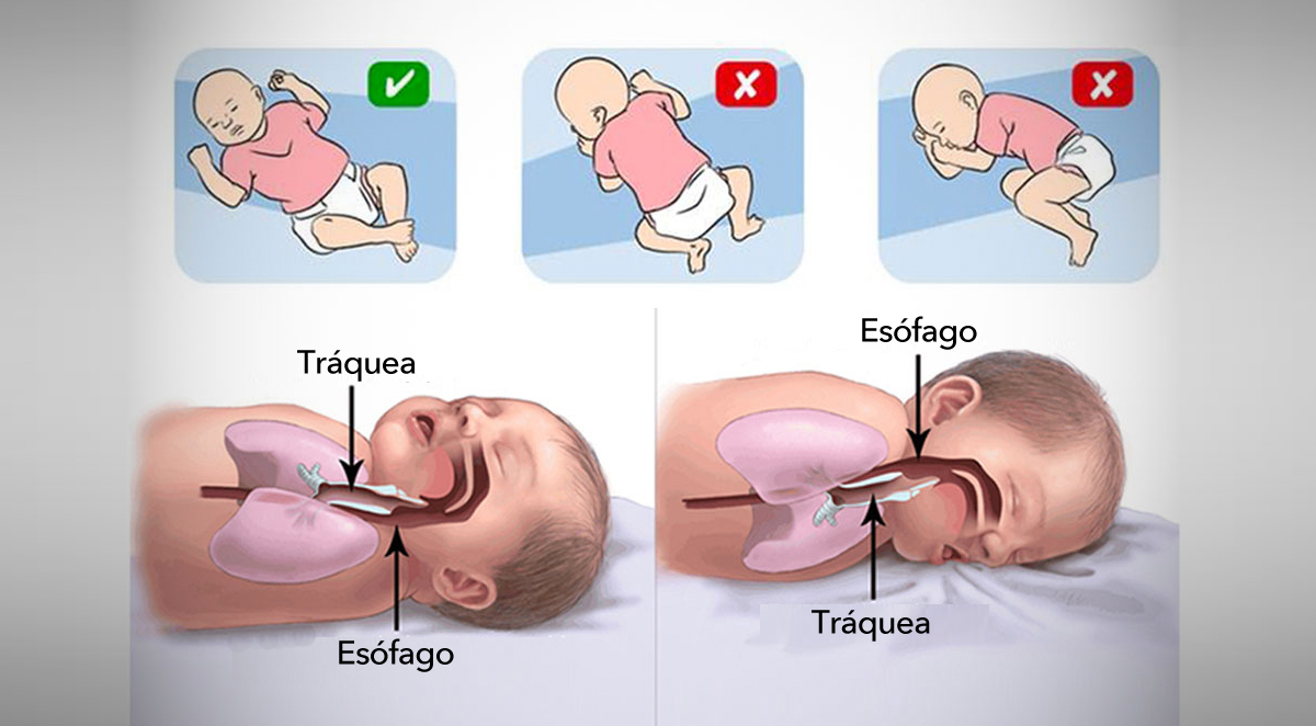 Síndrome de muerte súbita del lactante: Lo que se puede hacer para prevenirlo