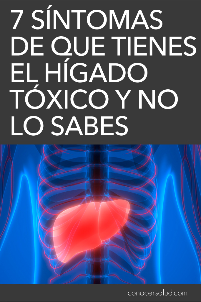 7 síntomas de que tienes el hígado tóxico y no lo sabes