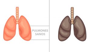 5 alimentos que desintoxican y curan sus pulmones naturalmente