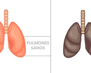 5 alimentos que desintoxican y curan sus pulmones naturalmente