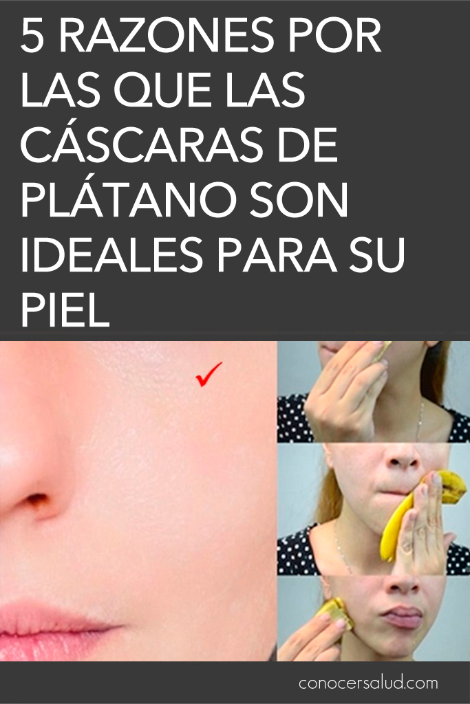 5 razones por las que las cáscaras de plátano son ideales para su piel