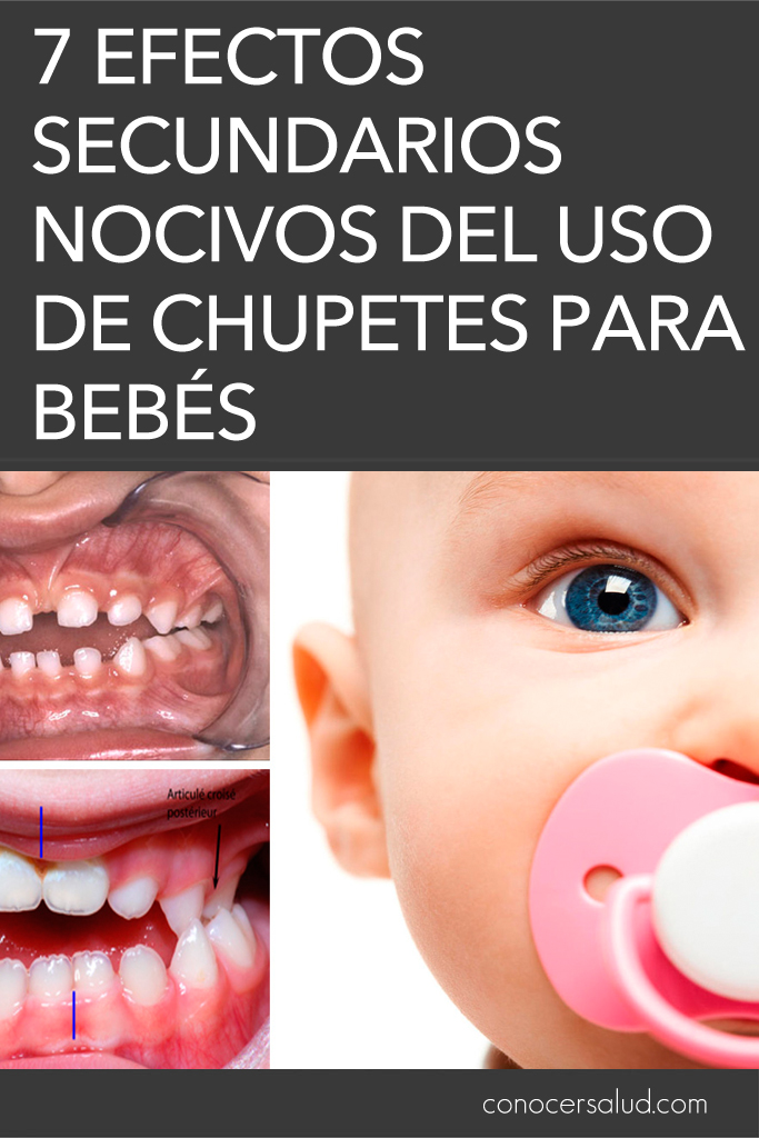 7 Efectos secundarios nocivos del uso de chupetes para bebés