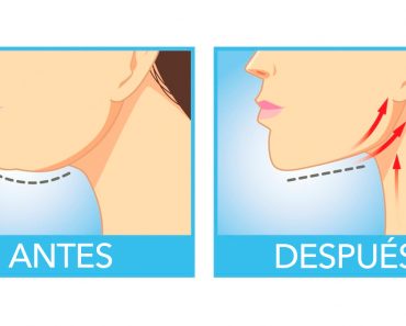 Los 5 métodos más eficaces para deshacerse de su papada Los 5 métodos más eficaces para deshacerse de su papada