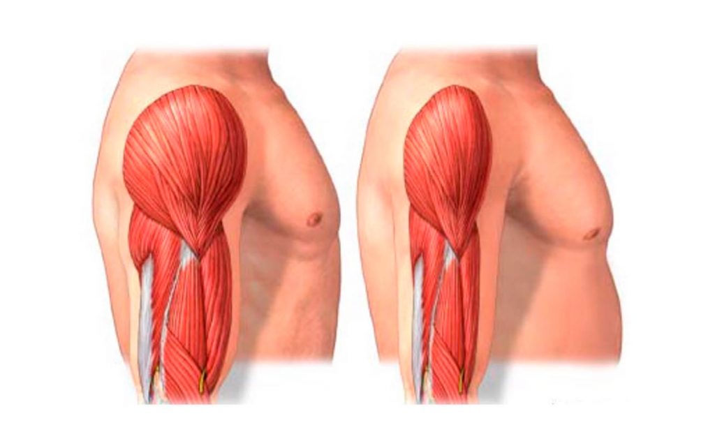 4 maneras de prevenir la pérdida muscular con la edad