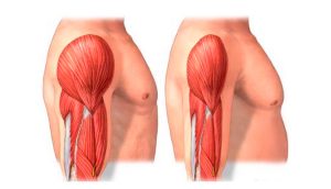 4 maneras de prevenir la pérdida muscular con la edad