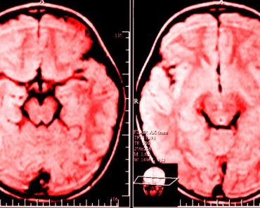 Investigación: quejarse cambia físicamente su cerebro para que esté ansioso y deprimido