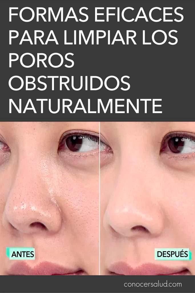 Formas eficaces para limpiar los poros obstruidos naturalmente