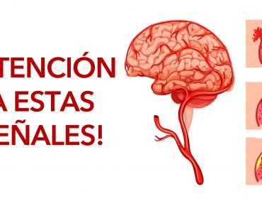 5 síntomas de derrame cerebral que la gente ignora