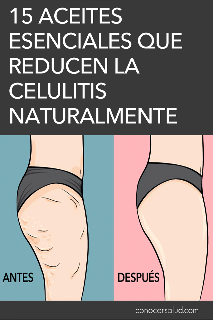 15 aceites esenciales que reducen la celulitis naturalmente