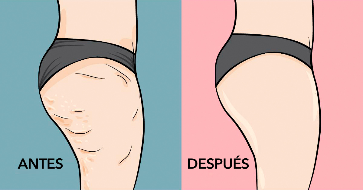 los mejores aceites vegetales para la celulitis