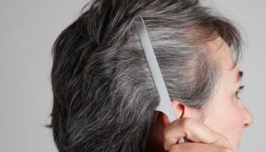 8 causas de las canas y 6 consejos naturales para prevenirlas